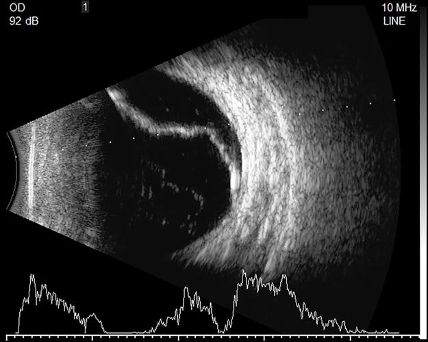 视网膜屏幕和4k哪个好，4k 视网膜-第2张图片-优品飞百科