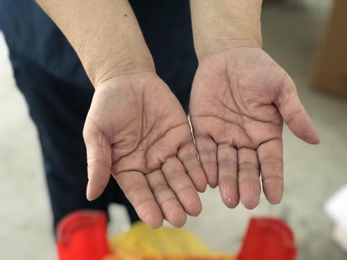 疫情感染过程,疫情感染是什么状态?-第1张图片-优品飞百科 疫情感染过程,疫情感染是什么状态?-第1张图片-优品飞百科