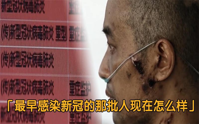 欧美疫情拐点，欧美疫情好转后利好哪些板块股票-第4张图片-优品飞百科