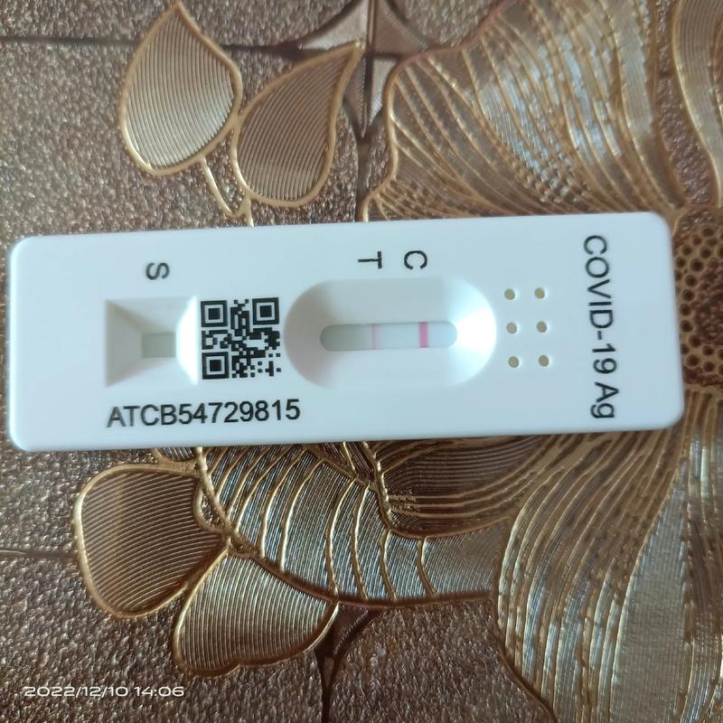 疫情查抗体？疫情抗体检测收费么？-第2张图片-优品飞百科