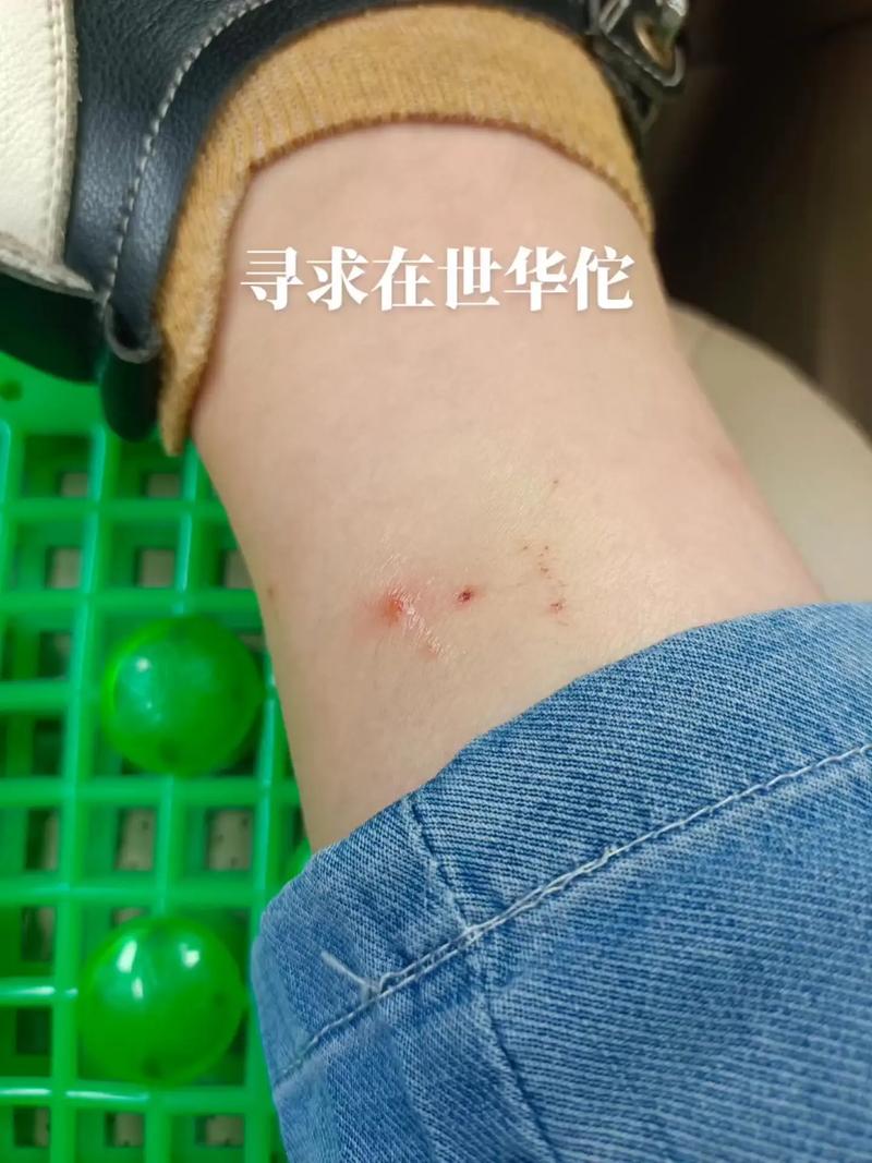 冠疫情疫苗，冠状疫情疫苗？-第3张图片-优品飞百科