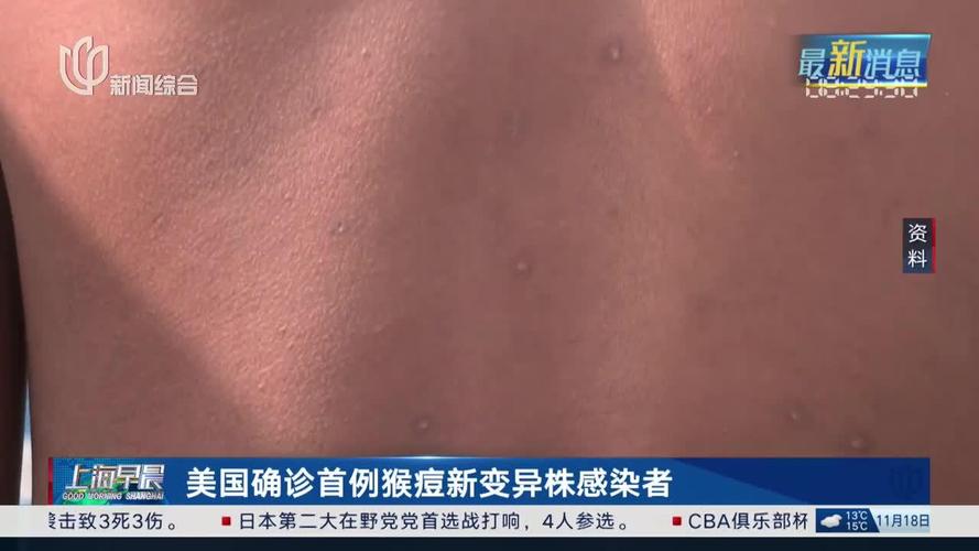 美国质疑疫情，美国质疑疫情防控措施