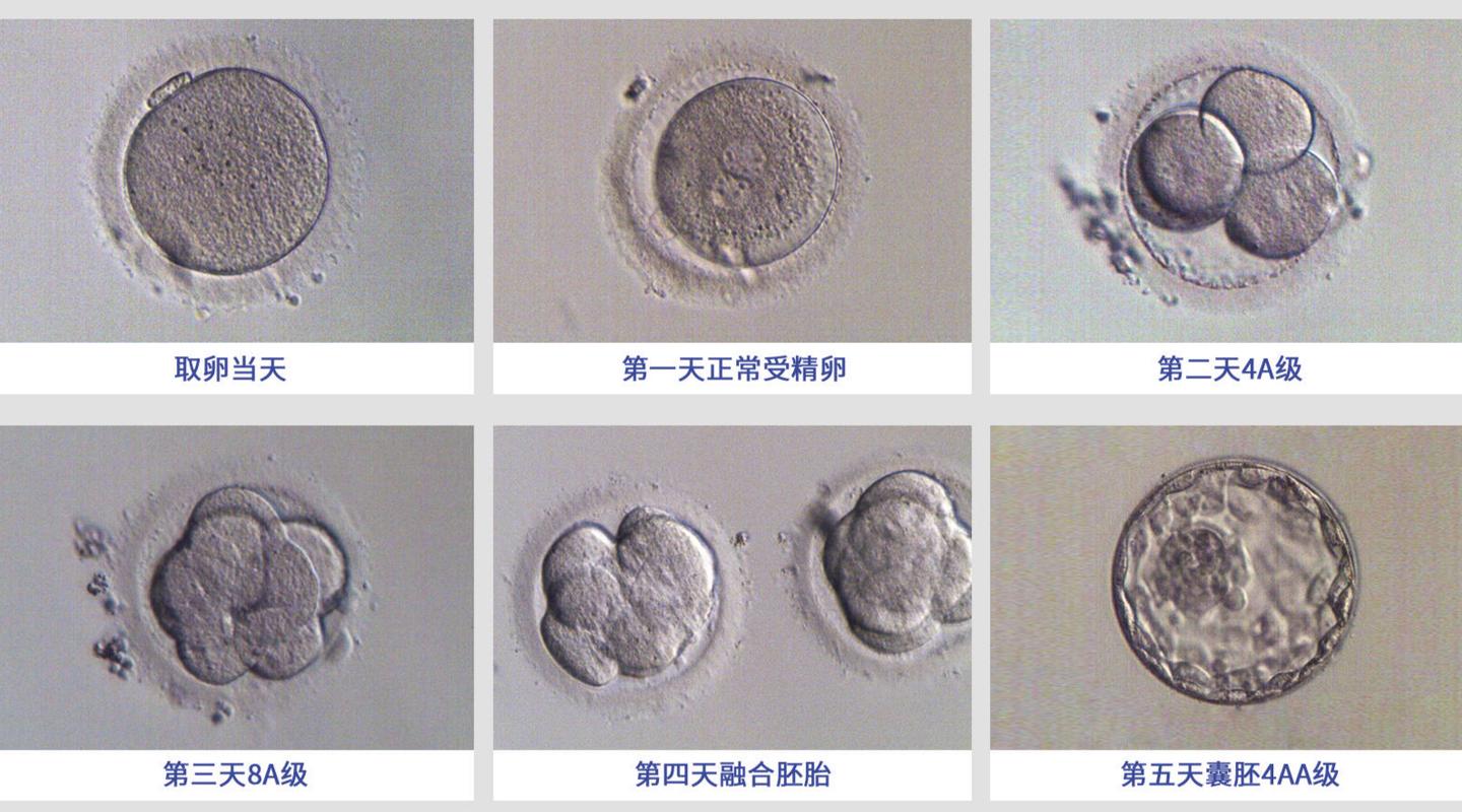 苹果4核和6核区别大吗，苹果四核处理器和六核处理器-第2张图片-优品飞百科