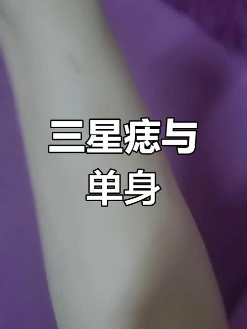 三星连珠痣长什么样？三星痣长什么样图片,三星连珠痣,人身上三星或七星标志？