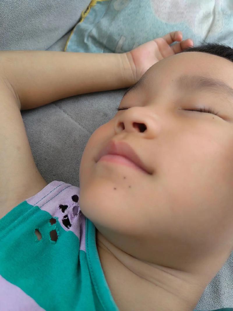 三星连珠痣长什么样？三星痣长什么样图片,三星连珠痣,人身上三星或七星标志？-第2张图片-优品飞百科