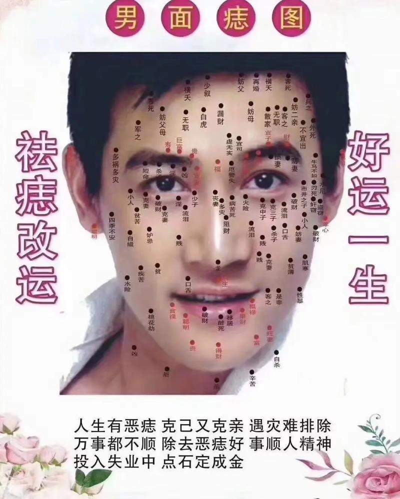 三星连珠痣长什么样？三星痣长什么样图片,三星连珠痣,人身上三星或七星标志？-第3张图片-优品飞百科