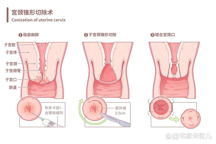 疫情手术过程，疫情手术视频