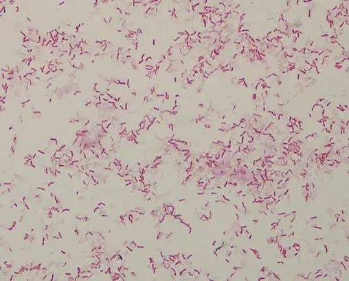 hp阳性的借鉴值是多少，hp值阳性代表什么意思？-第4张图片-优品飞百科