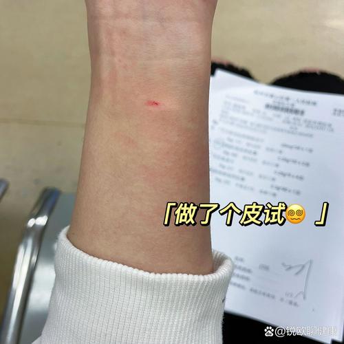 hp阳性的借鉴值是多少，hp值阳性代表什么意思？-第5张图片-优品飞百科