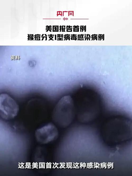 美国疫情病历，美国疫情病例数据-第5张图片-优品飞百科