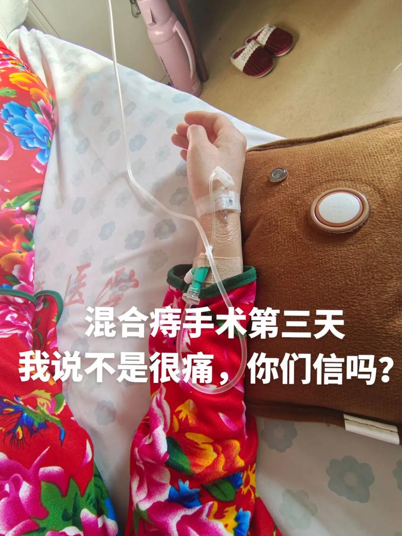 关于疫情期间肛裂的信息-第4张图片-优品飞百科 关于疫情期间肛裂的信息-第4张图片-优品飞百科