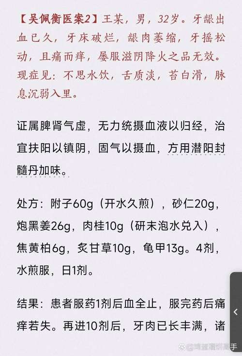 疫情的中药汤？疫情中药汤走向世界？-第3张图片-优品飞百科