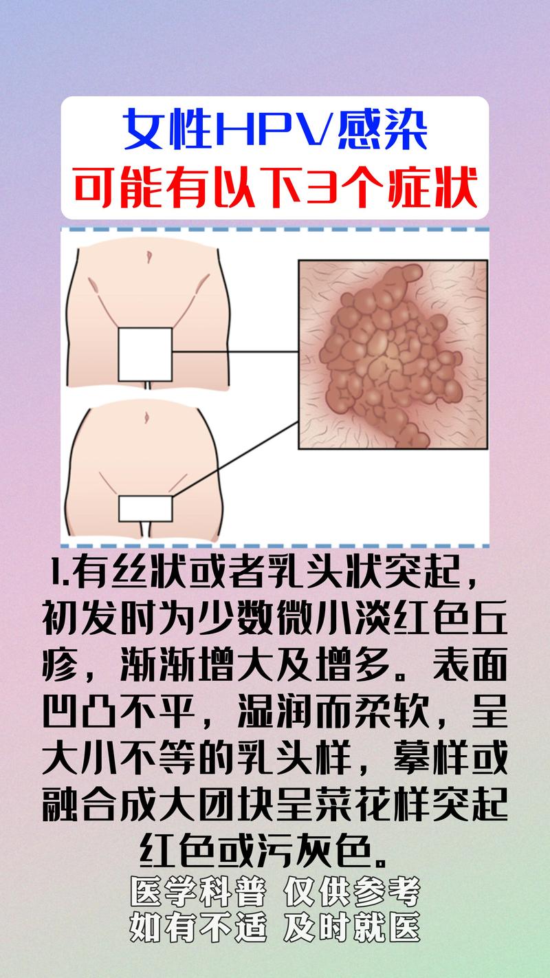 hp感染会传染吗，hp感染会传染吗女性？-第4张图片-优品飞百科