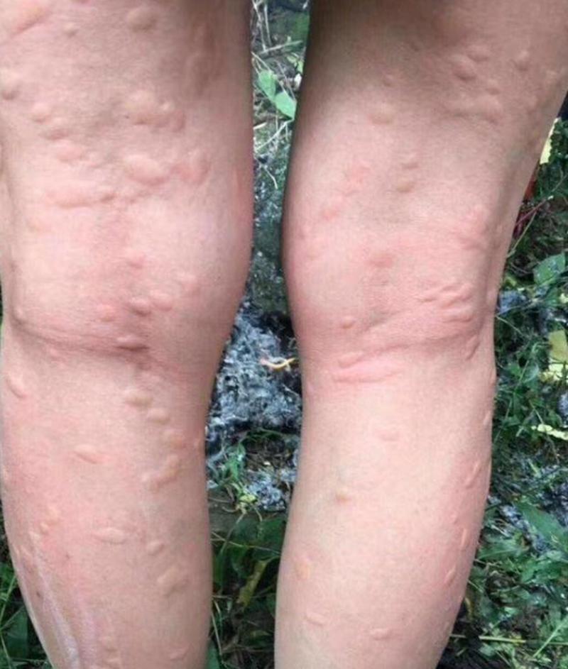 广州疫情咬人，广州疫情恐慌-第6张图片-优品飞百科