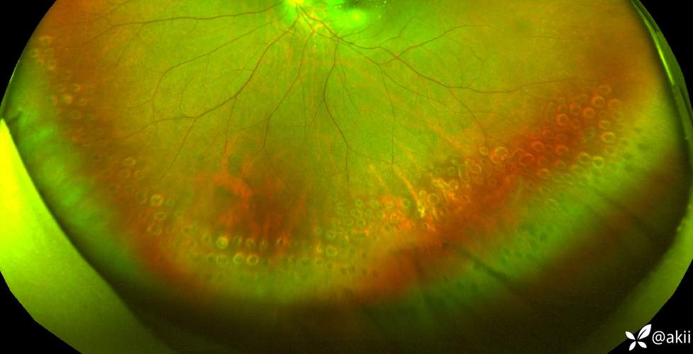 视网膜屏幕有什么好处？视网膜屏幕的好处坏处？-第1张图片-优品飞百科