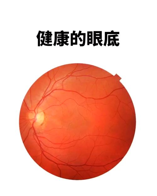 视网膜屏幕有什么好处？视网膜屏幕的好处坏处？-第2张图片-优品飞百科