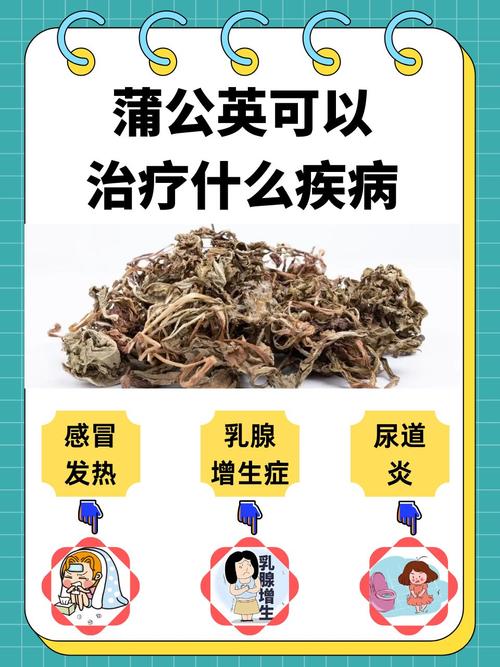 蒲公英抗疫情，蒲公英抗病毒作用大吗？-第3张图片-优品飞百科