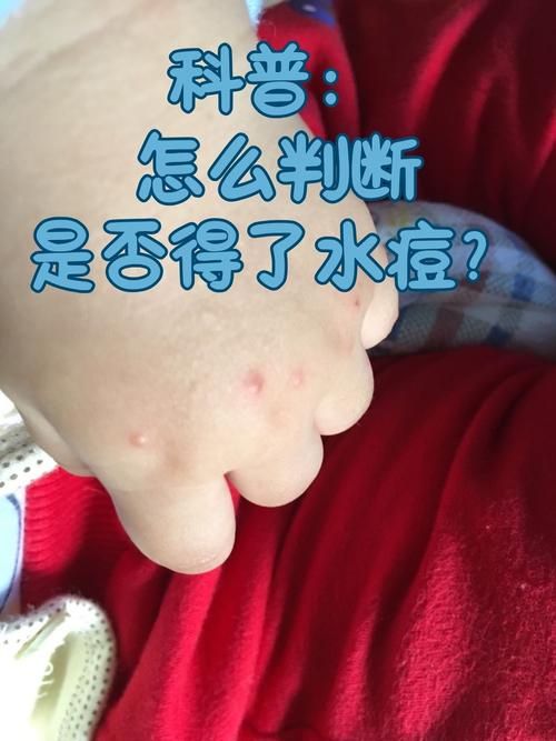 疫情症状与时间，疫情的症状前期症状？-第6张图片-优品飞百科