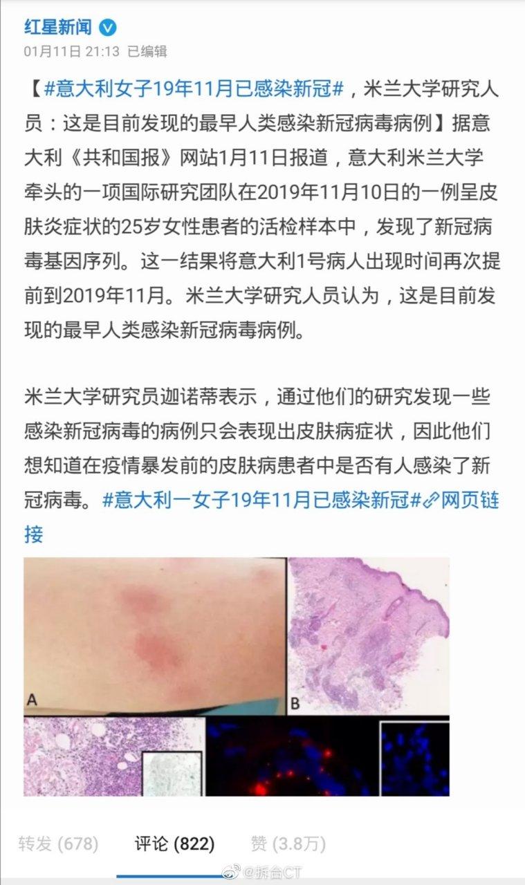 意大利疫情武汉，意大利 武汉 病毒株-第8张图片-优品飞百科