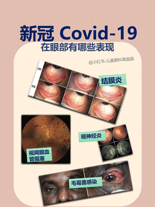 疫情出门标准，疫情出门标准是什么-第2张图片-优品飞百科