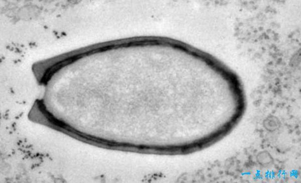 疫情死亡复活，疫情死亡场面？-第3张图片-优品飞百科