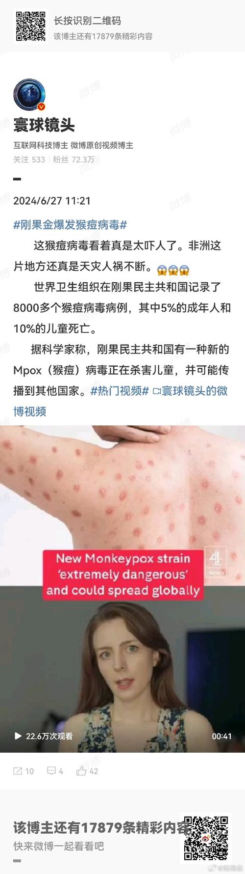 关于疫情如果失控的信息-第2张图片-优品飞百科