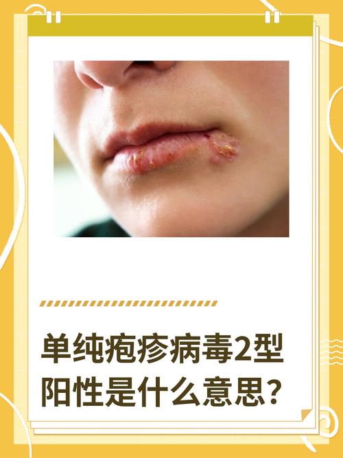 疫情活动是检，疫情检疫-第6张图片-优品飞百科