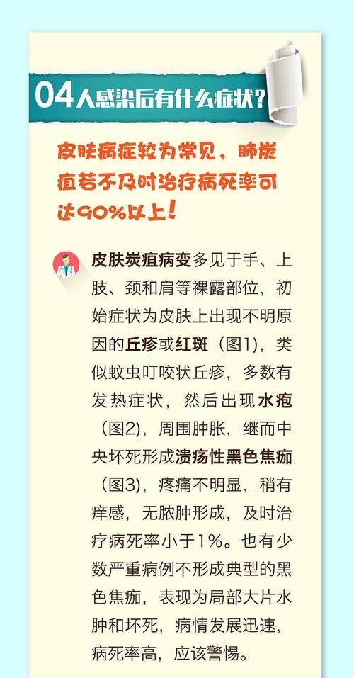 炭疽疫情症状，炭疽疫情症状表现-第3张图片-优品飞百科