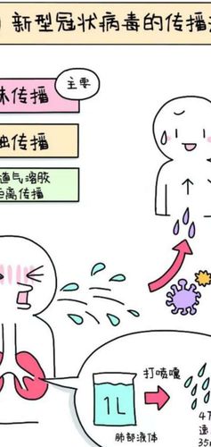 疫情传染有哪些，疫情传染有哪些症状-第5张图片-优品飞百科