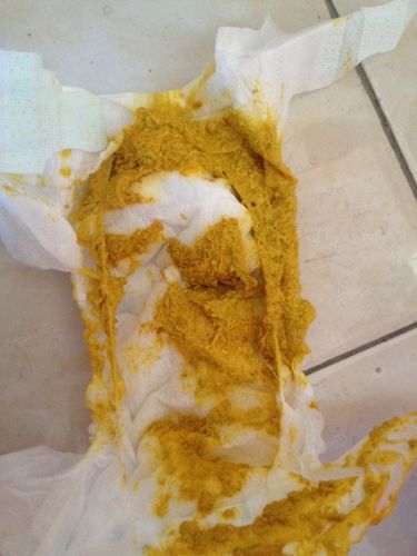 疫情期间孕吐，疫情期间呕吐物怎么处理？-第4张图片-优品飞百科