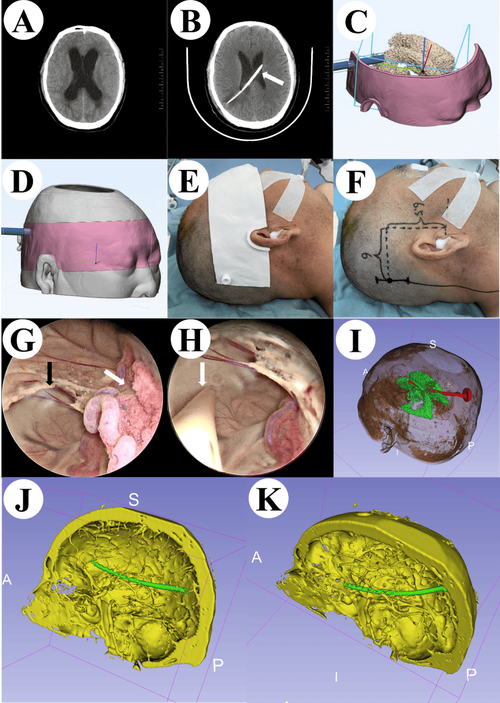 沙子3d打印机多少钱一台，砂石3d打印机多少钱？-第6张图片-优品飞百科