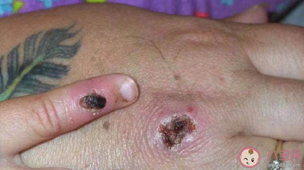 法国疫情轻症？法国疫情已受控？-第3张图片-优品飞百科