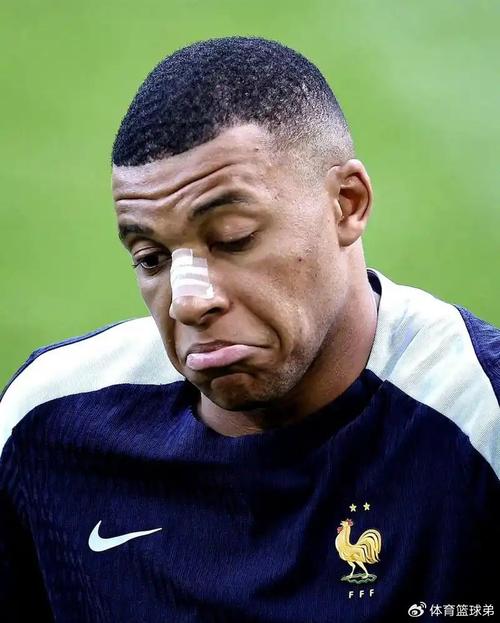 法国疫情轻症？法国疫情已受控？-第4张图片-优品飞百科