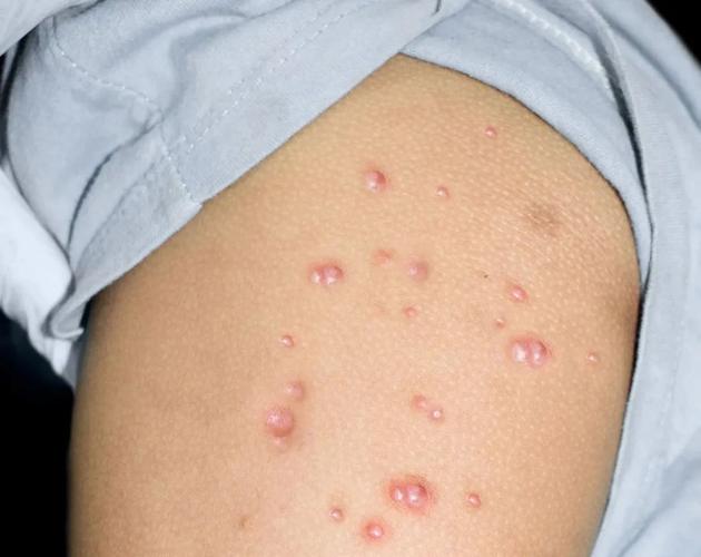 意大利疫情首例，意大利疫情2019-第7张图片-优品飞百科