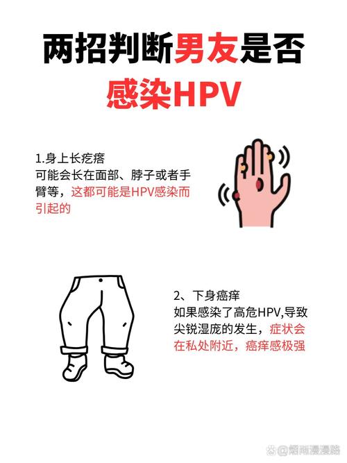 男性hpv怎么检查，男性HPV怎么检查治疗？-第3张图片-优品飞百科