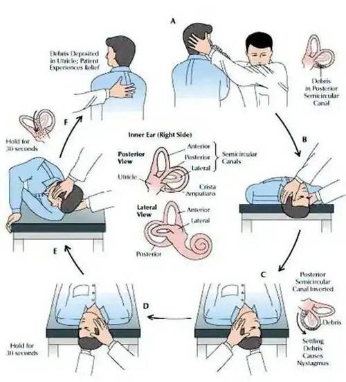 晕3d游戏怎么快速缓解，晕3d游戏怎么办好受点？-第4张图片-优品飞百科