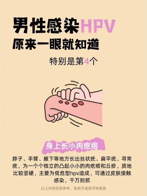 hpv感染症状可以治愈吗？hpv感染症状可以治愈吗女性？-第1张图片-优品飞百科
