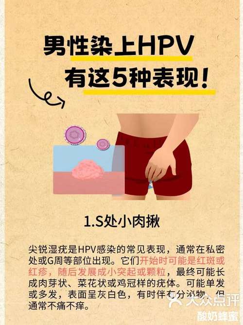 hpv感染跟男性有关吗，hpv感染跟男的有关系吗-第3张图片-优品飞百科