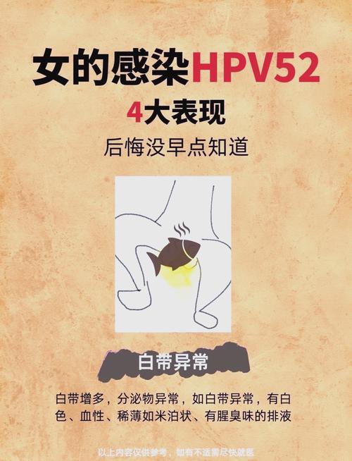 hpv52阳性怎么治疗转阴？hpv52阳性怎么治愈？-第1张图片-优品飞百科