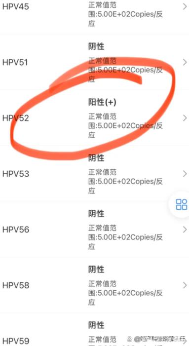 hpv52阳性怎么治疗转阴？hpv52阳性怎么治愈？-第2张图片-优品飞百科
