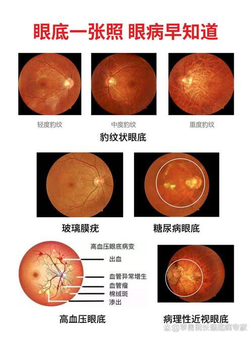 视网膜屏幕分辨率是多少，视网膜屏幕相当于几k？