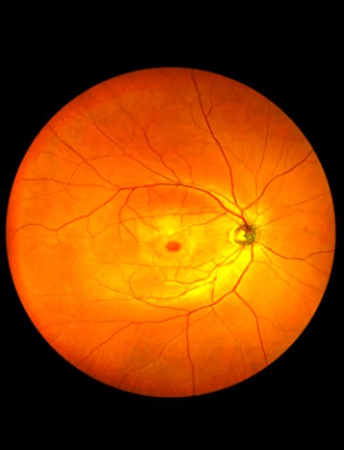 视网膜屏幕分辨率是多少，视网膜屏幕相当于几k？-第3张图片-优品飞百科