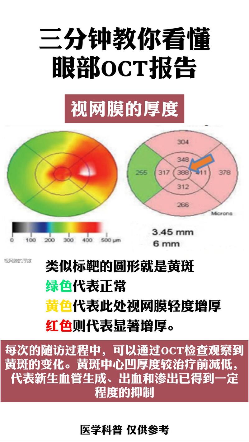 视网膜屏幕分辨率是多少，视网膜屏幕相当于几k？-第6张图片-优品飞百科